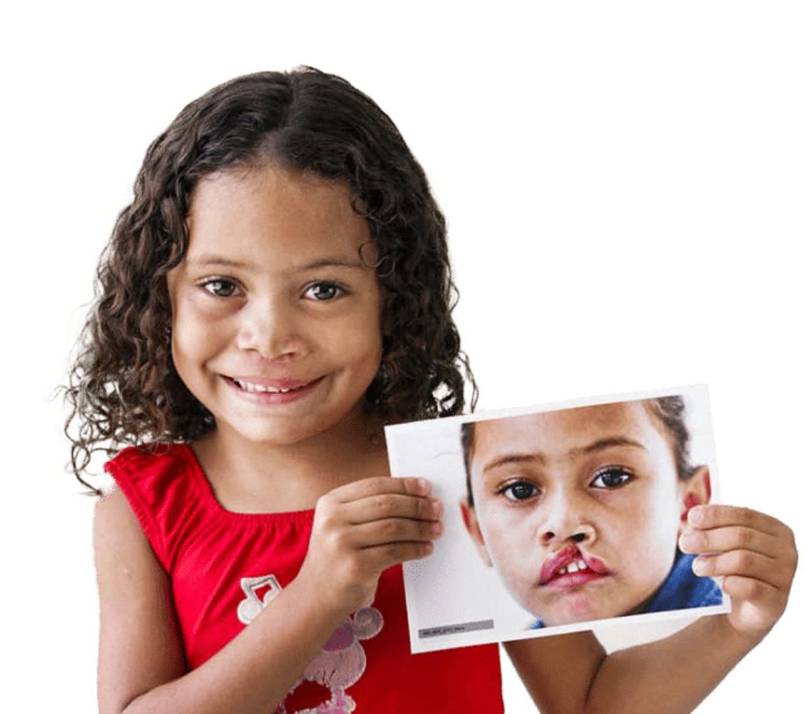 Ortodonzia in esiti di labiopalatoschisi presso lo studio dentistico Semeraro a Martina Franca