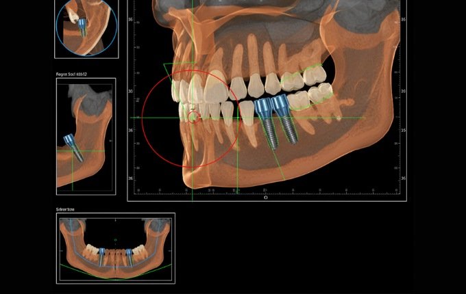 TAC 3D Cone Beam Studio Odontoiatrico Semeraro a Martina Franca